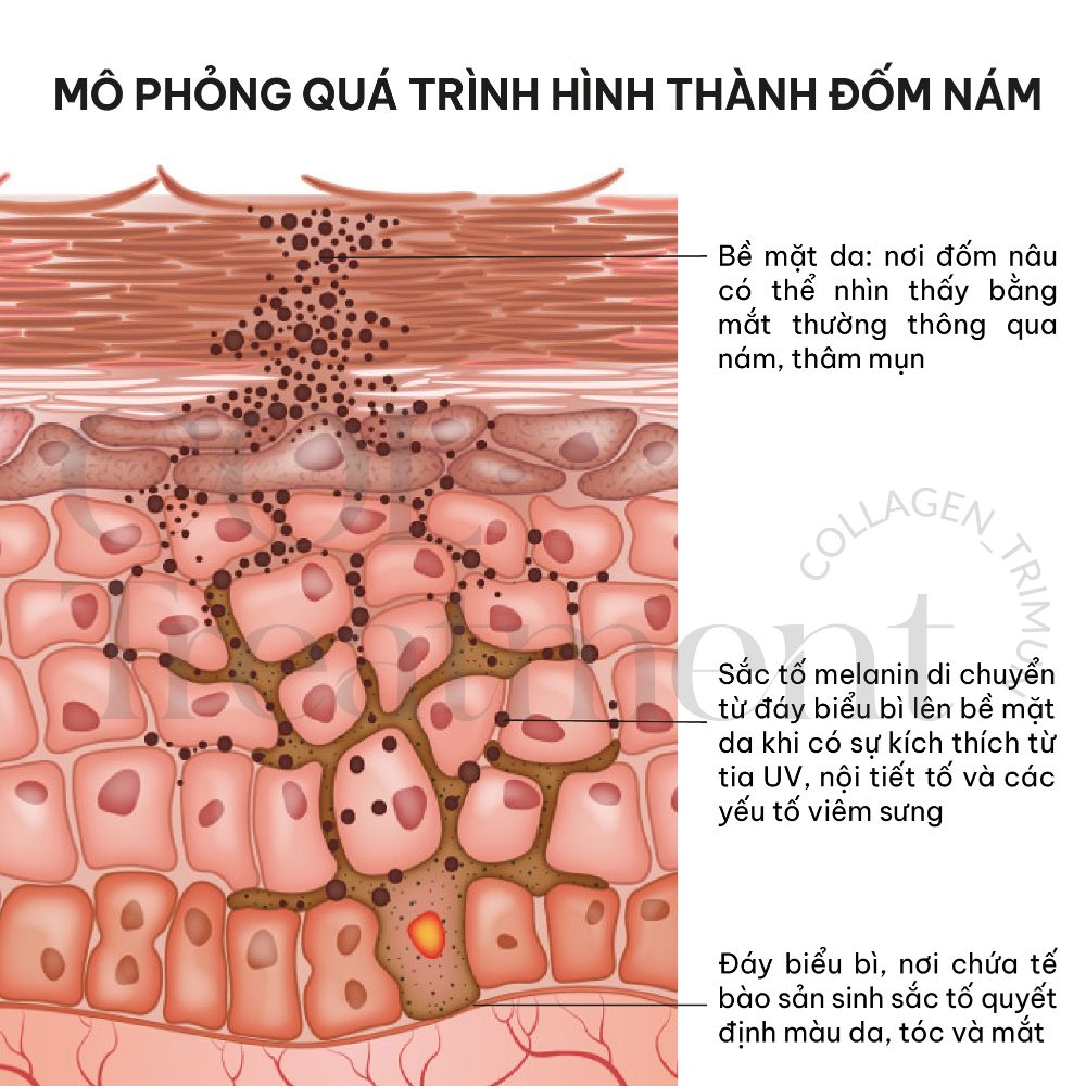 Kem hay thuốc trị nám ở Hàn tốt không?